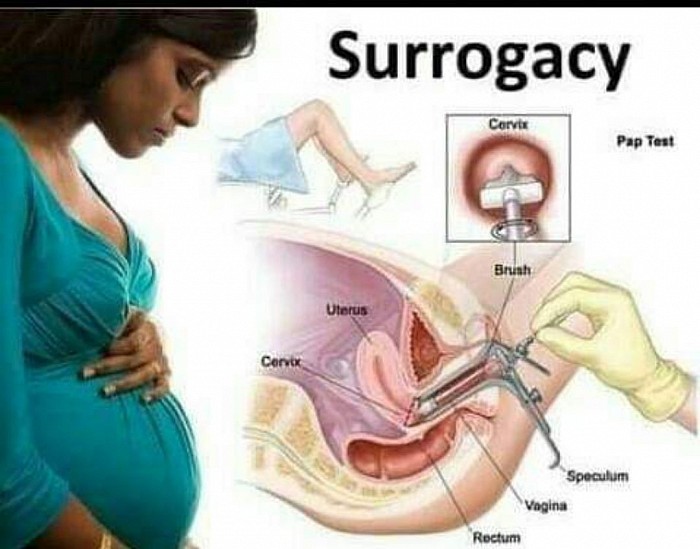 An Example of Embryo transplant.           Choose IVF Today Choose BLESSED WORLD 🌏 SURROGACY AGENCY